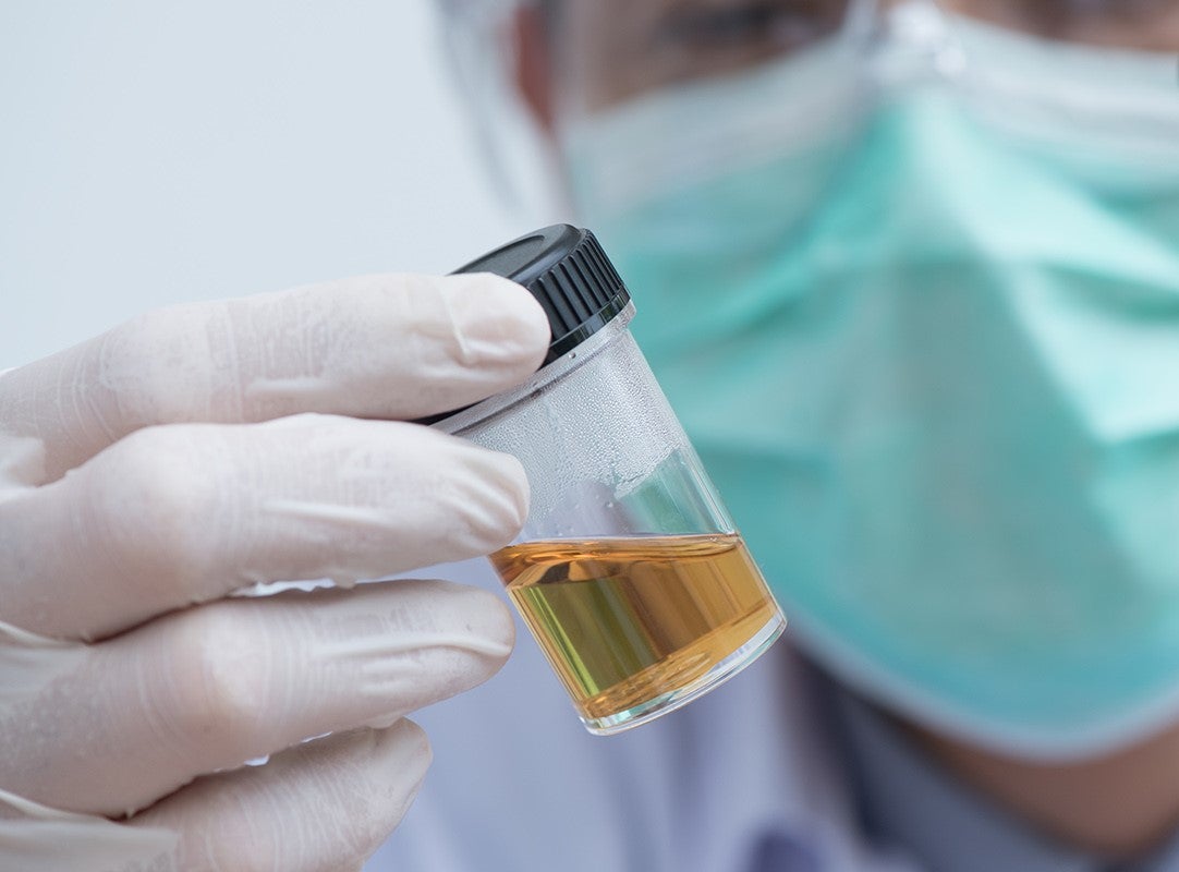 Why Banned Substance Testing Is Important to Athletes GNC